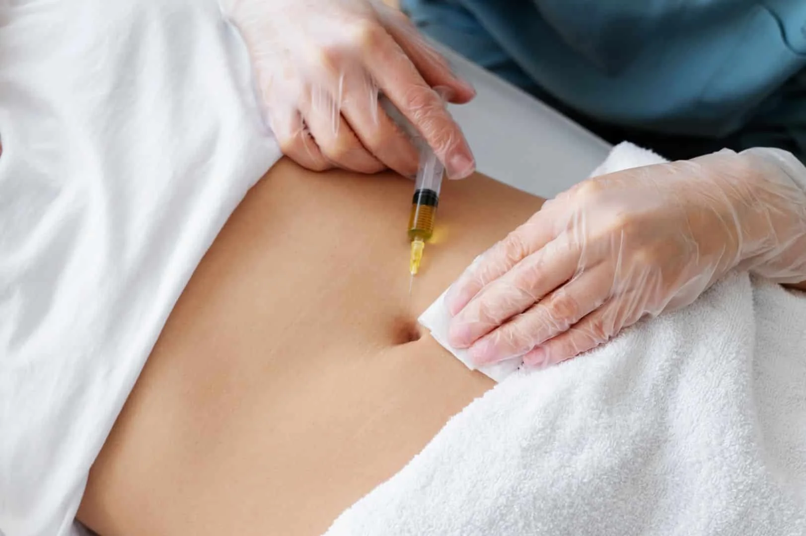Tratamiento de mesoterapia en un entorno clínico